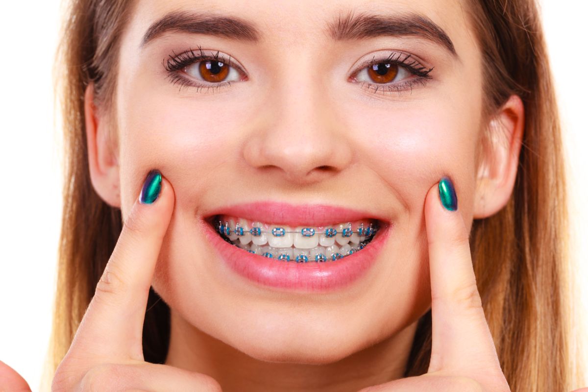 Bad Habits to Break Whether You Have Braces or Not