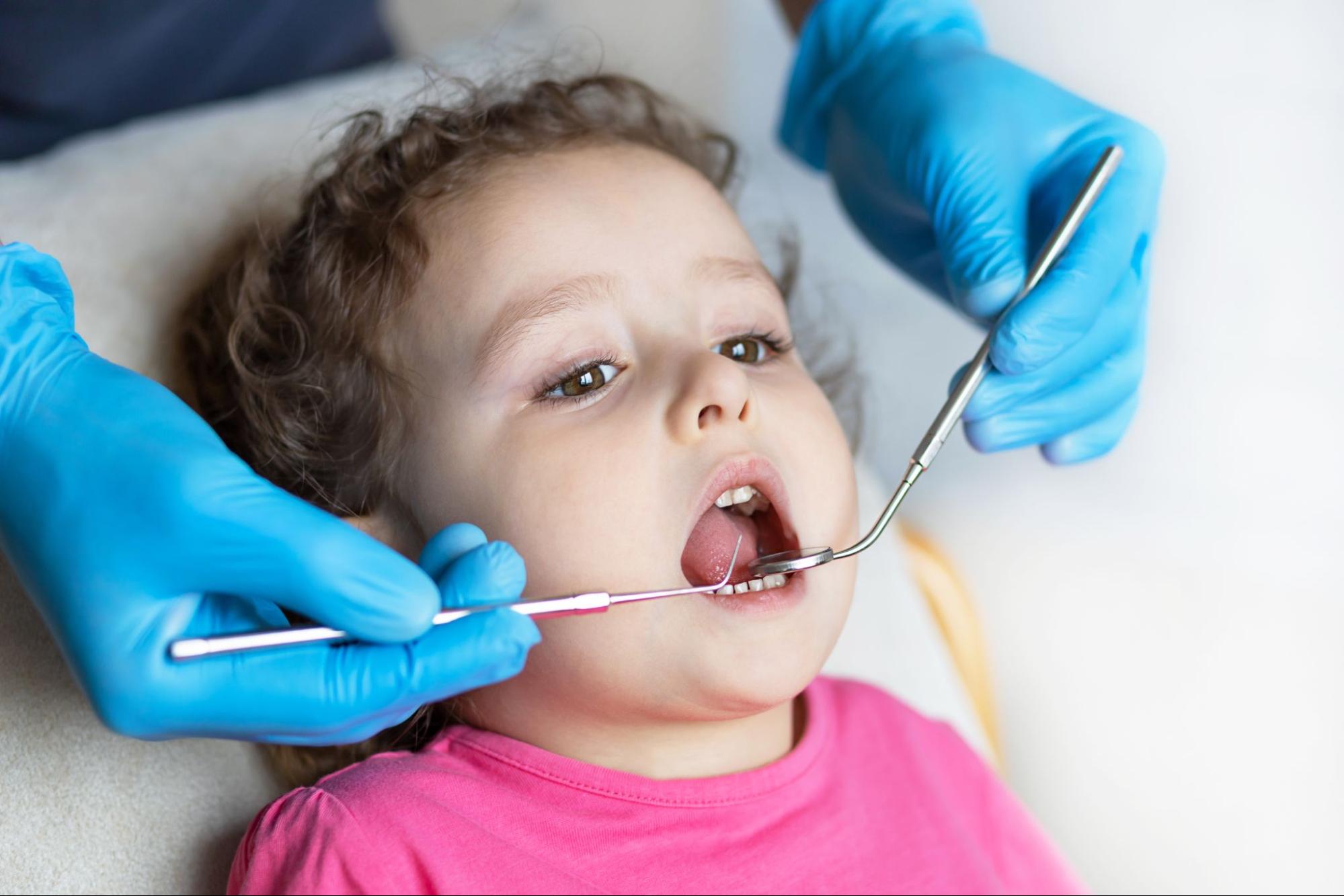 What Is Early Interceptive Orthodontic Treatment?