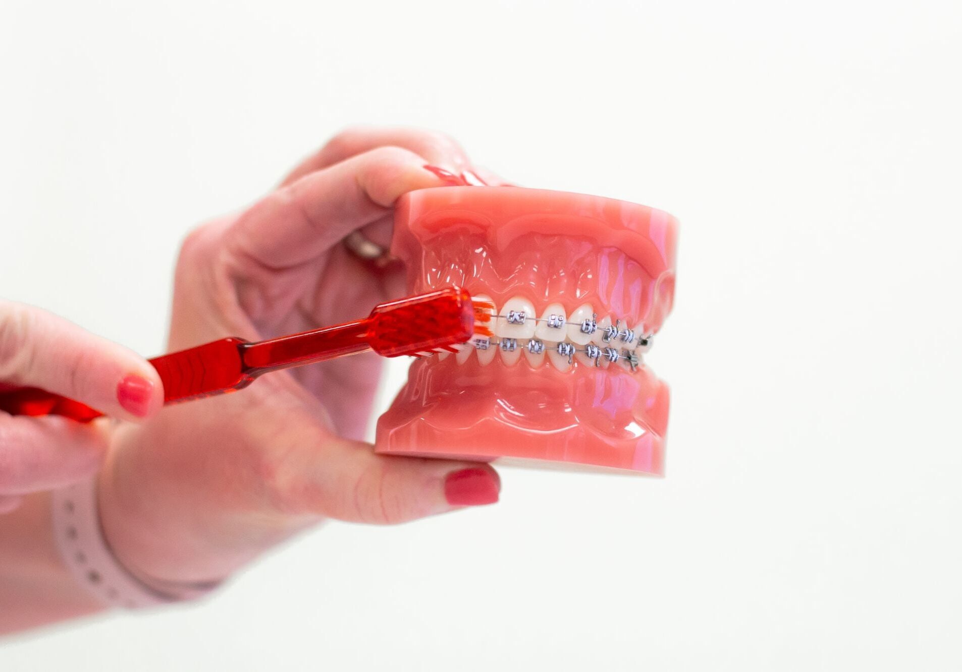 Orthodontic care and braces maintenance tips from Wiesemann Orthodontics serving Portland TN and White House TN